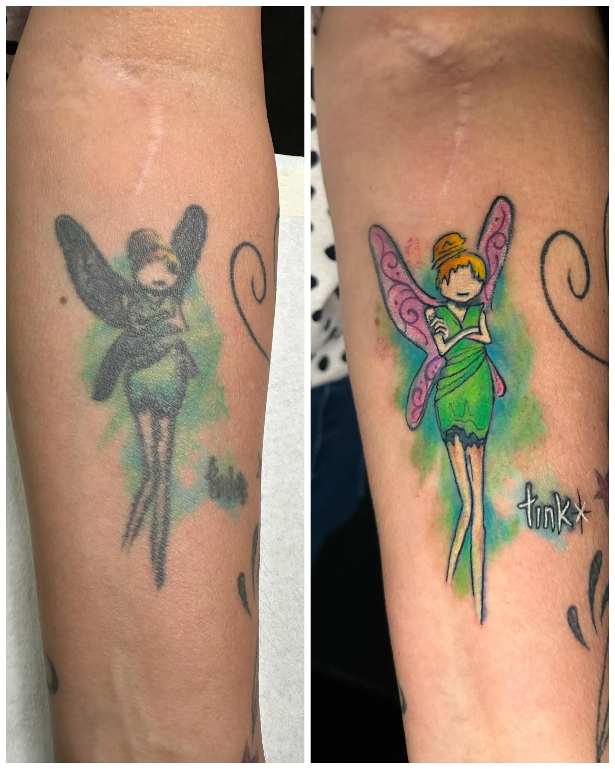 Tinkerbell tattoo rework on the arm, transforming a faded fairy into a vibrant watercolor Disney design, artistic restoration in Boca Raton, Florida.