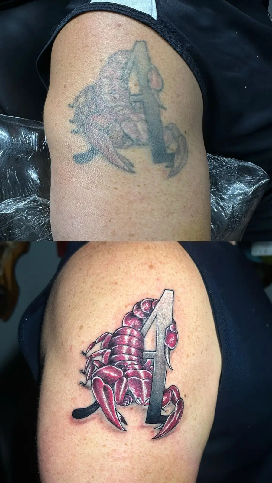 Scorpion tattoo cover-up transformation on the shoulder, replacing a faded symbol with a realistic red arachnid design, inked in Boca Raton, Florida.